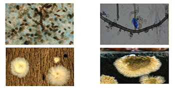 霉菌對(duì)人體的危害,你都知道嗎?