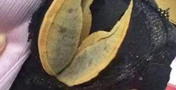 內衣發霉怎么辦？霉博來士教你除霉措施！