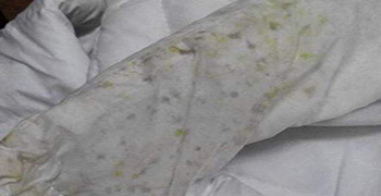 冬季服裝發(fā)霉，如何去霉防霉？