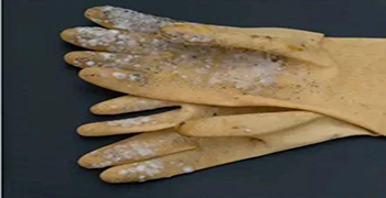 微生物災害所涉及的領域有多少（三）？