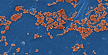 細菌毒素有哪些?